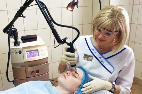 Beauty salon laser rejuvenation procedure