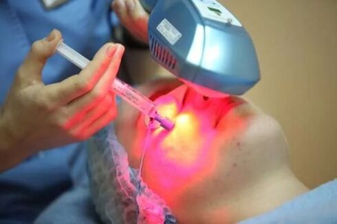 Facial skin laser biorevitalization