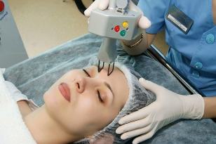 Laser fractionated facial skin rejuvenation